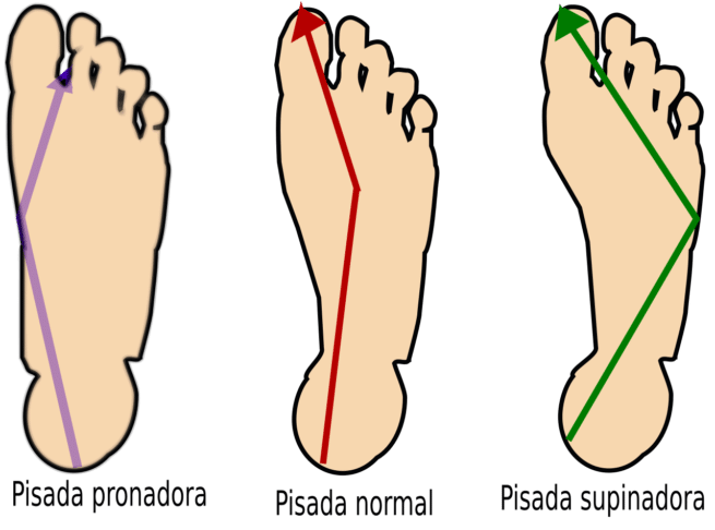 ¿Pronador O Supinador? - Clínica Fuensalud