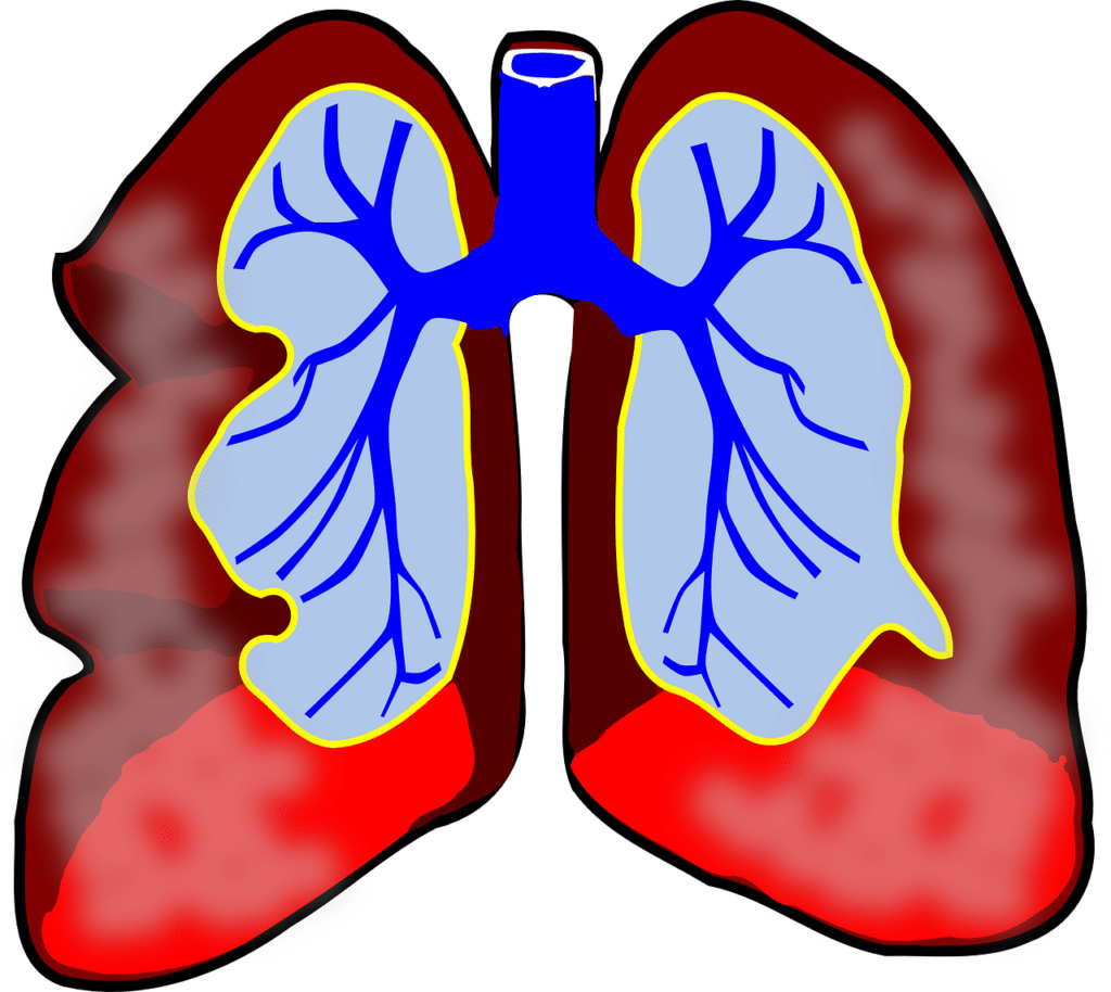 Fisioterapia respiratoria por Clínica Fuensalud